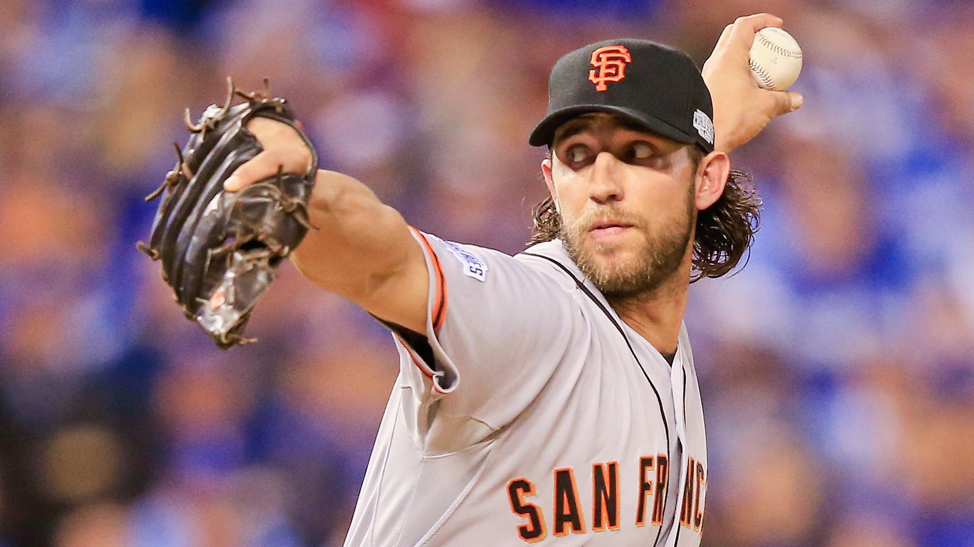 Madison Bumgarner injury